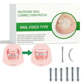 Titanium Alloy Ingrown Toenail Treatment, Ingrown Toenail Removal Kit for Curved Nail Repair, Nail Tools, Ingrown Nail Tool for Home Use (0.59/0.67in) SPYFAMILY 6 ()